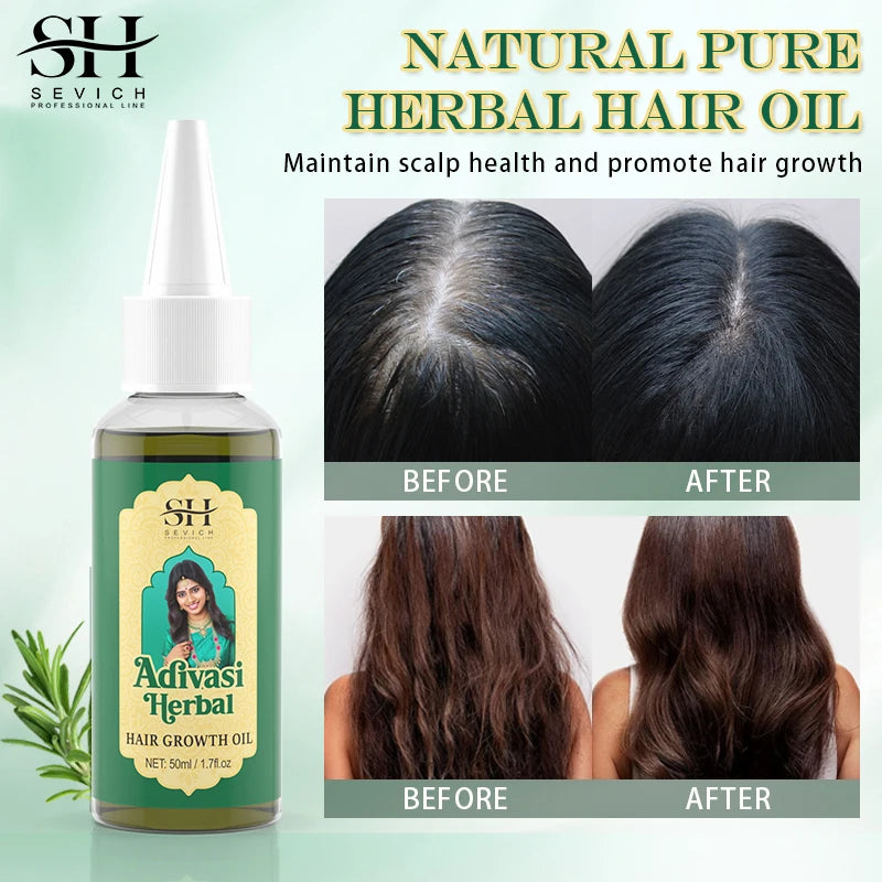 Adivasi Essence: Ayurvedic Hair Growth Serum
