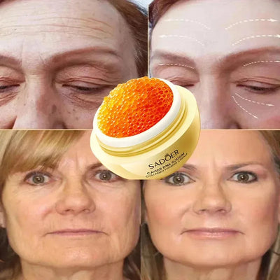 ✨ Caviar Supreme – Luxe Huidverjonging ✨