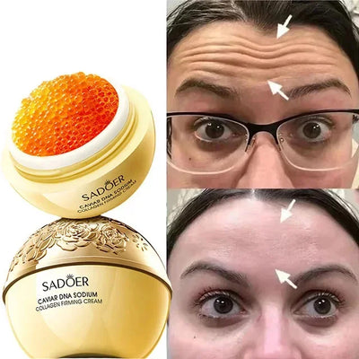 ✨ Caviar Supreme – Luxe Huidverjonging ✨